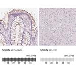 MUC12 Antibody in Immunohistochemistry (IHC)