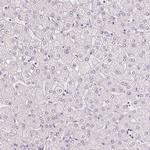 MUC12 Antibody in Immunohistochemistry (IHC)