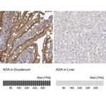 Adenosine Deaminase Antibody in Immunohistochemistry (IHC)