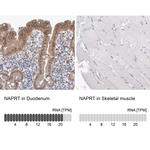 NAPRT1 Antibody in Immunohistochemistry (IHC)