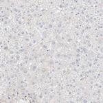 LMCD1 Antibody in Immunohistochemistry (IHC)