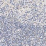 HDHD3 Antibody in Immunohistochemistry (IHC)