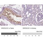 SPATA31E1 Antibody