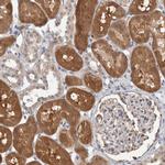 CARKL Antibody in Immunohistochemistry (IHC)