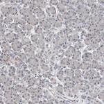 CARKL Antibody in Immunohistochemistry (IHC)