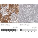 CARKL Antibody