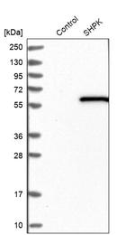 CARKL Antibody in Western Blot (WB)