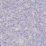 KLF17 Antibody in Immunohistochemistry (IHC)