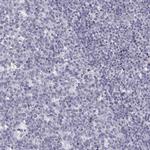 KLF17 Antibody in Immunohistochemistry (IHC)