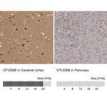 OTUD6B Antibody in Immunohistochemistry (IHC)