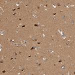 OTUD6B Antibody in Immunohistochemistry (IHC)