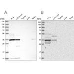 OTUD6B Antibody in Western Blot (WB)