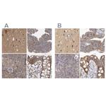 BZRAP1 Antibody in Immunohistochemistry (IHC)