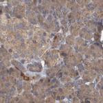 BZRAP1 Antibody in Immunohistochemistry (IHC)