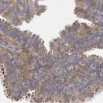 BZRAP1 Antibody in Immunohistochemistry (IHC)