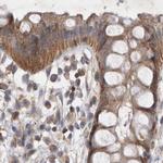 BZRAP1 Antibody in Immunohistochemistry (IHC)