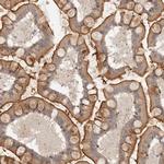 MICALL2 Antibody in Immunohistochemistry (IHC)