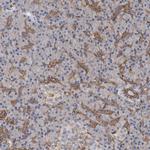 Plectin Antibody in Immunohistochemistry (IHC)