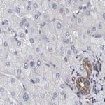 Plectin Antibody in Immunohistochemistry (IHC)