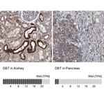 DBT Antibody