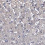 DBT Antibody in Immunohistochemistry (IHC)