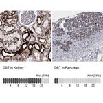 DBT Antibody