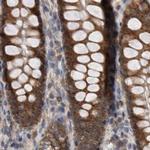 AspRS Antibody in Immunohistochemistry (IHC)