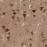 PRKAR1B Antibody in Immunohistochemistry (IHC)