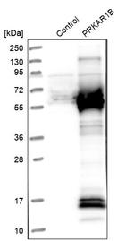 PRKAR1B Antibody in Western Blot (WB)