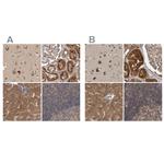 TRMT61B Antibody in Immunohistochemistry (IHC)