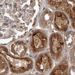 TRMT61B Antibody in Immunohistochemistry (IHC)