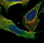 Caspase 14 Antibody in Immunocytochemistry (ICC/IF)