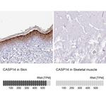 Caspase 14 Antibody in Immunohistochemistry (IHC)