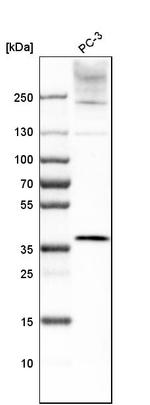 Lass2 Antibody in Western Blot (WB)
