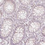 GNMT Antibody in Immunohistochemistry (IHC)