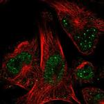 POLE2 Antibody in Immunocytochemistry (ICC/IF)