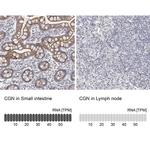 CGN Antibody in Immunohistochemistry (IHC)