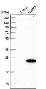 HSPB7 Antibody in Western Blot (WB)