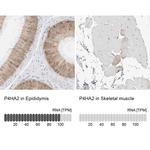 P4HA2 Antibody in Immunohistochemistry (IHC)