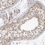 MRPS15 Antibody in Immunohistochemistry (IHC)