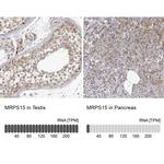 MRPS15 Antibody