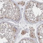 LZIC Antibody in Immunohistochemistry (IHC)