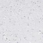 FMNL1 Antibody in Immunohistochemistry (IHC)