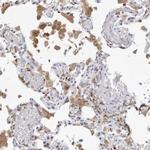 FMNL1 Antibody in Immunohistochemistry (IHC)