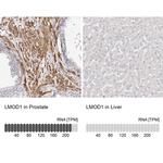 LMOD1 Antibody in Immunohistochemistry (IHC)