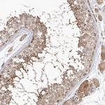 NSUN4 Antibody in Immunohistochemistry (IHC)