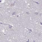 KIAA1751 Antibody in Immunohistochemistry (IHC)