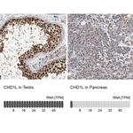 CHD1L Antibody in Immunohistochemistry (IHC)