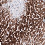 HSD17B13 Antibody in Immunohistochemistry (IHC)