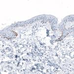 HSD17B13 Antibody in Immunohistochemistry (IHC)